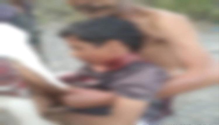 إصابة طفل برصاص قناصة حوثي في لحج