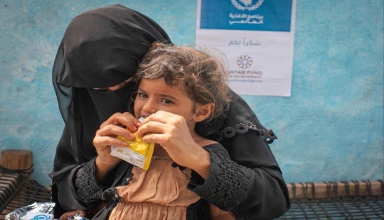 تقرير: سيتوقف علاج حالات سوء التغذية لدى الأطفال في مناطق الحوثيين نهاية الشهر الجاري