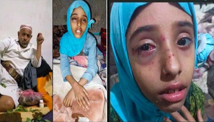 رجل مُسن يعتدي على طفلة وامها في إب