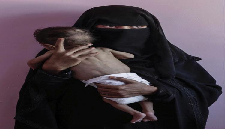 أمهات اليمن في خطر.. أرقام أممية تكشف حجم الكارثة
