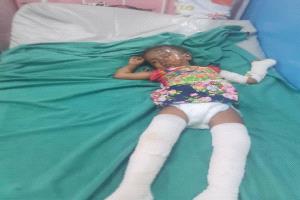 بسبب تسرب أسطوانة غاز منزلي.. حريق يصيب أسرة في حي الطميسي بزنجبار ومناشدة إنسانية عاجلة لإنقاذها