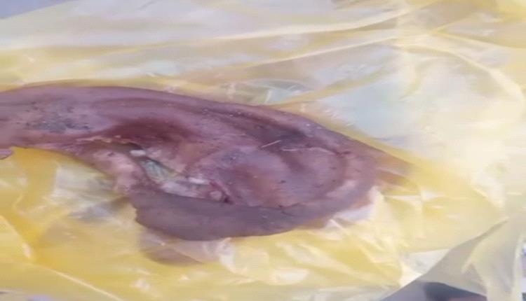 شجار في سوق زنجبار بأبين ينتهي بعضّ أذن أحد المتعاركين وقطعها بالكامل