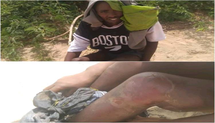 ارتفاع الانتهاكات والابتزاز ضد المهاجرين الأفارقة المسلمين في مديرية أحور