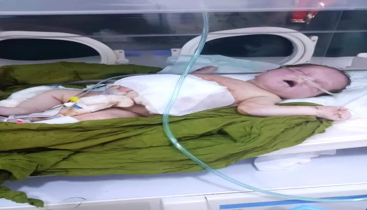 نجاح عملية جراحية دقيقة لطفل حديث الولادة في مستشفى الغيضة المركزي