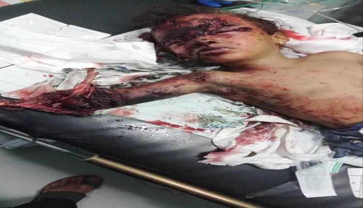 انفجار لغم أرضي يودي بحياة طفلة في محافظة الضالع